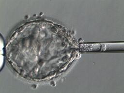 着床前検査のため受精卵から細胞を取り出す様子(慶応大病院提供)